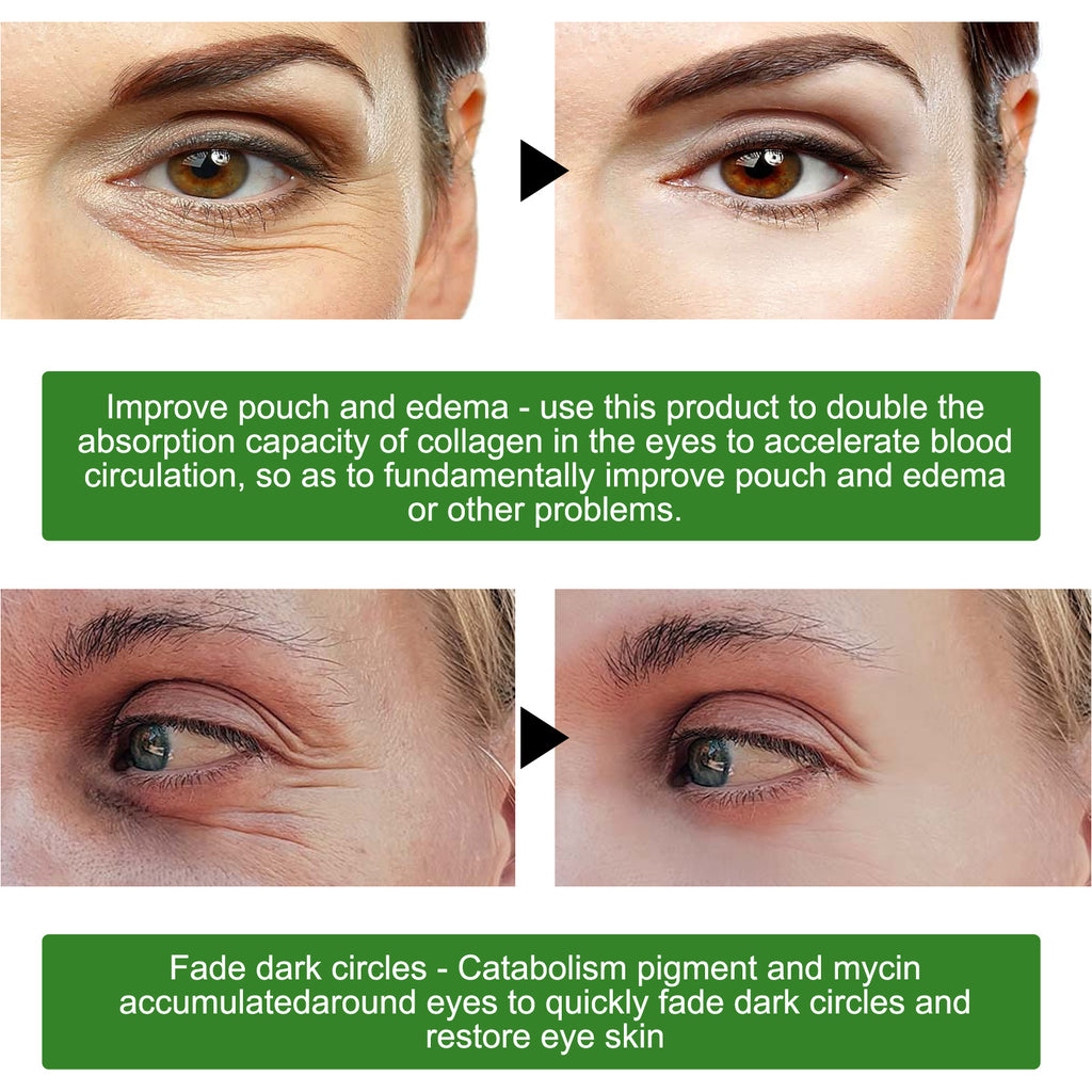 EELHOE Seaweed Firming Eye Mask, Gentle Moisturizing, Nourishing And Caring Eye Mask For Daily Eye Care